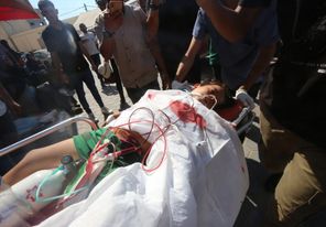 إصابة طفلة بنيران الاحتلال شمال غزة