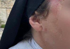 إصابة راهبة باعتداء مستعمر في القدس المحتلة