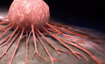 نتائج مبشرة للقاح شخصي ضد سرطان الجلد بتقنية (mRNA)