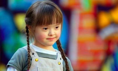 تطور في تعديل الجينات قد يؤدي إلى علاج لمتلازمة داون