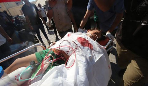 إصابة طفلة بنيران الاحتلال شمال غزة